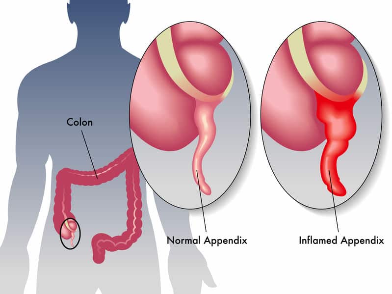 22 key causes of abdominal pain – stomach pain explained