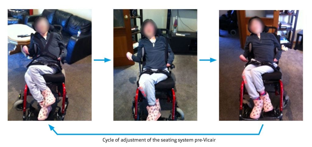Clinical Case Cycle of Adjustment of the Seating System pre-Vicair