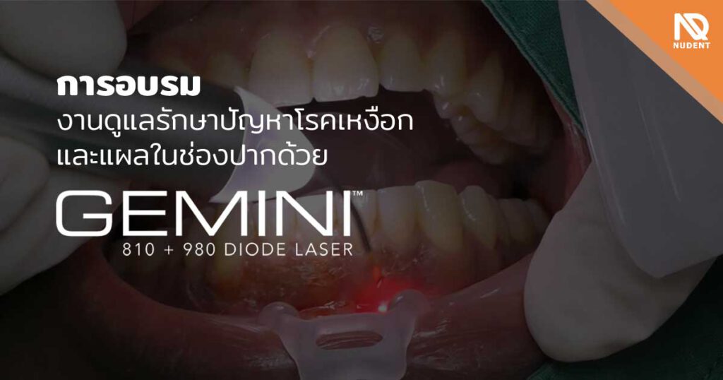 รักษาปัญหาโรคเหงือกและแผลในช่องปาก