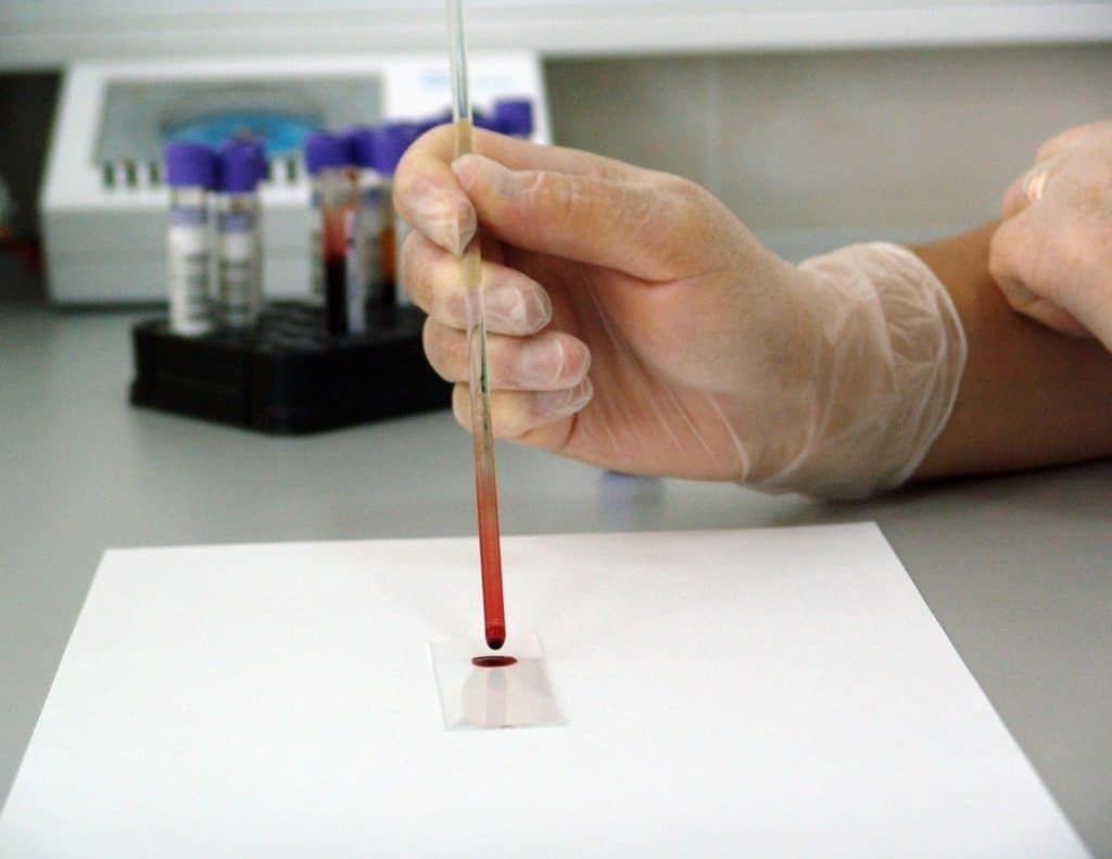 Hand holding a pipette with dark fluid, ready to run a test