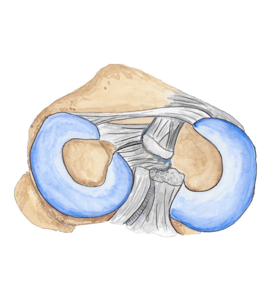 Résection du ménisque où méniscectomie. Dr Even Résection du ménisque où méniscectomie. Dr Even