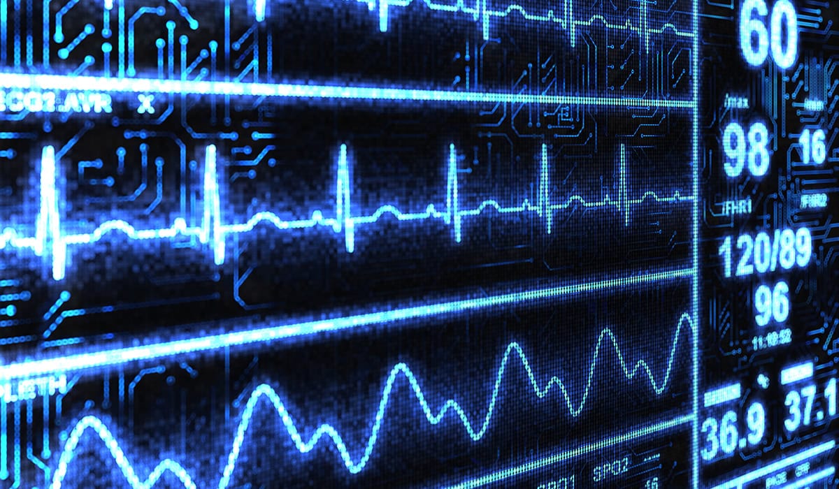 Cardiac Monitor