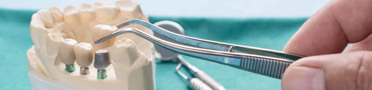topDentalProcedures Top Dental Procedures
