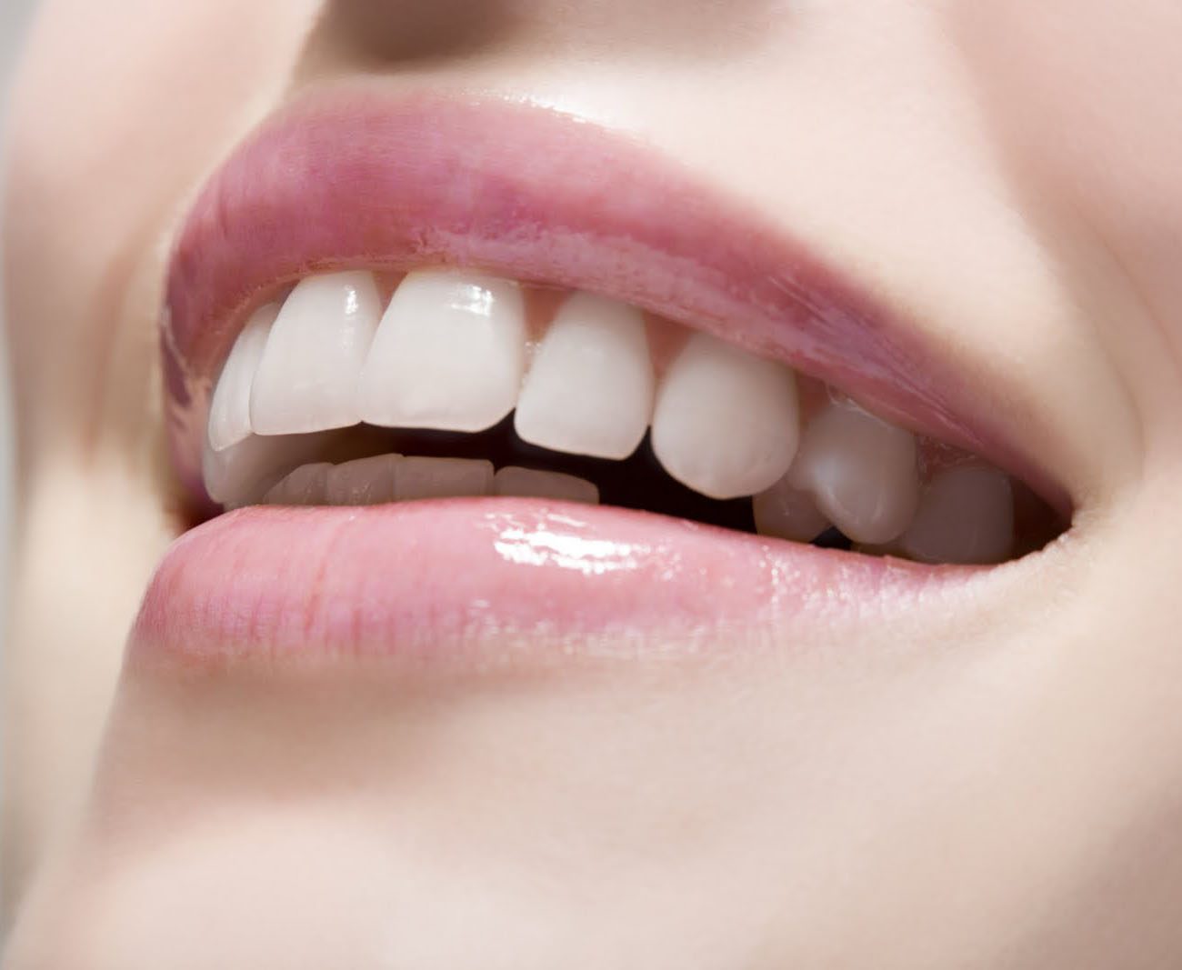 Dental Implants Cost in Dubai