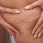 お腹や太もものセルライトを自宅で軽減できるお風呂で体を温め脂肪を柔らかくして・・