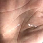 broken life line, break in life line, meaning of broken line, short life line,