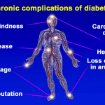 can type 2 diabetes be reversed and cured