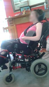 Seating Adjusted Vicair wheelchair cushion Clinical Case