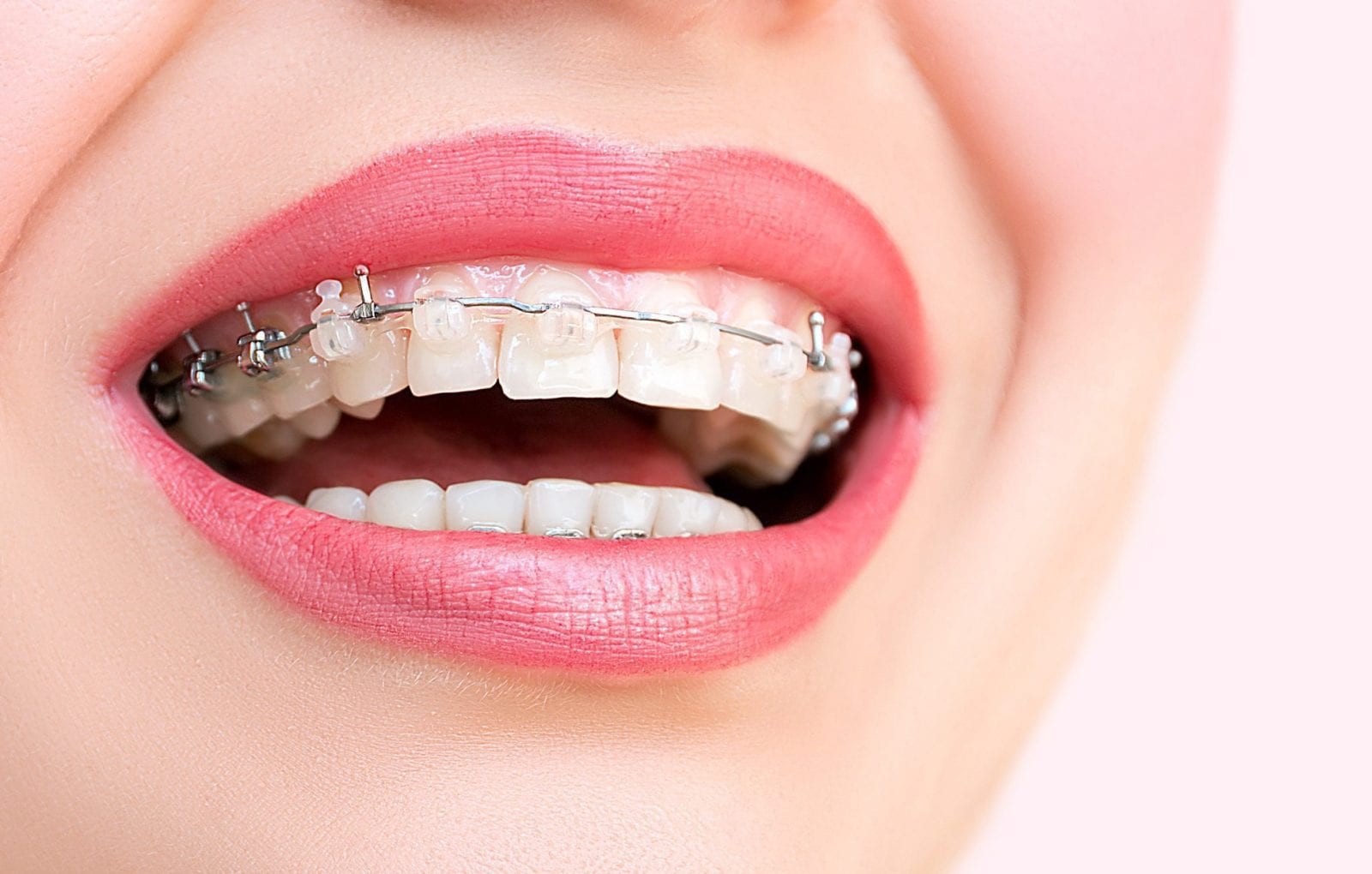 Orthodontist Dubai