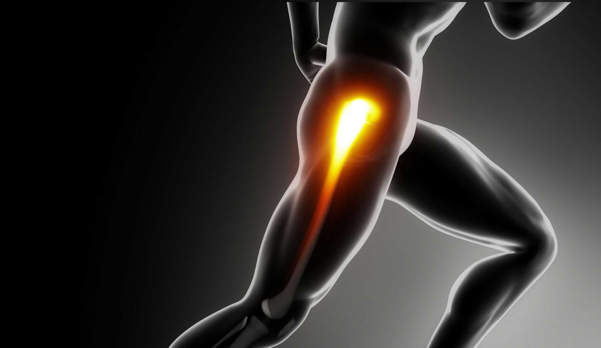 Hip Pain in Phoenix - illustration of hip pain