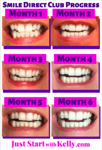 SDC progress pics with monthly labels