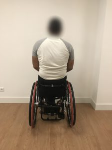 Clinical Case Vicair New Set-Up