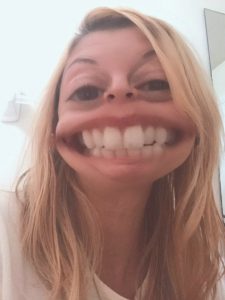Tooth alignment photo