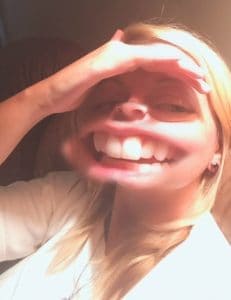 Tooth alignment photo