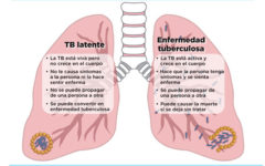 latente_tb latente_tb