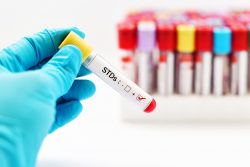 Telemedicine Enables Faster Testing for Bloodborne Pathogen Exposure Telemedicine Enables Faster Testing for Bloodborne Pathogen Exposure