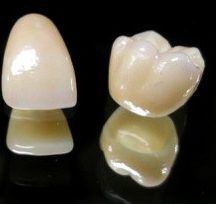 Bruxzir Crown Cost
