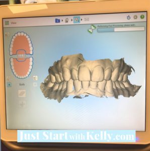 3d scan of teeth
