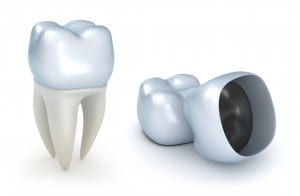 Crowns