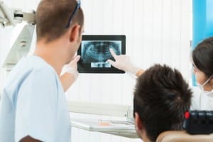Wisdom Teeth Removal, Collingwood & Midland, ON