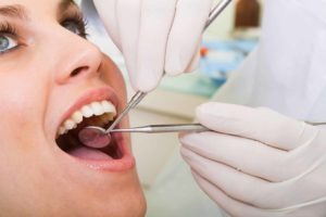 Care for Implants