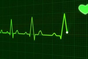 Heart Monitor