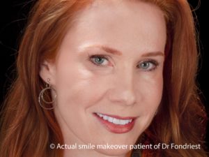 Cosmetic Dentistry