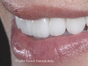 healthy teeth with tooth pain Relieve a toothache