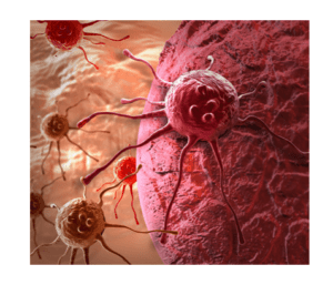 Analysis of cancer cells with Impedance Flow Cytometry
