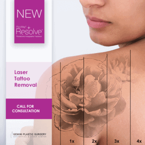 Tattoo Laser Hair Removal in Rancho Cucamonga