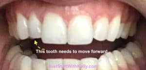 shot of teeth