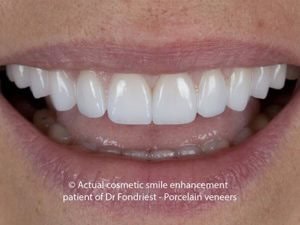 Conservative Dentistry