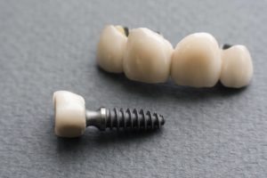 Do you want a new tooth?