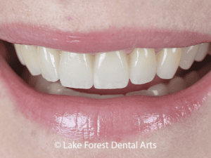 esthetic restorative care
