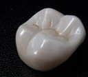 Affordable Bruxzir Crown