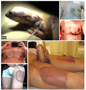 What Makes Somebody Real Trans Part 2 Kids Lily Maynard Less than a year after having gender surgery, nathaniel now says, this whole thing was a bad idea. what makes somebody real trans part