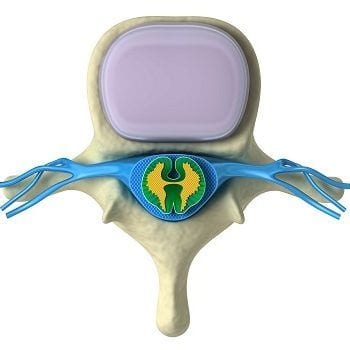 Spinalnerven Die Spinalnerven können durch verschiedenste Ursachen in Mitleidenschaft gezogen werden, dazu gehören ein Bandscheibenvorfall, Infektionen oder Metastasen.