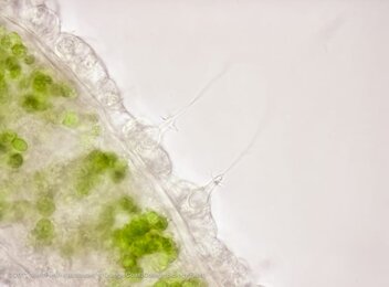 Nematocysts on hydra tentacle