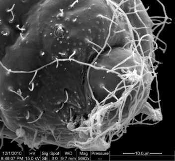 Hydra viridis tentacle
