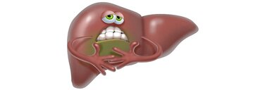 Leververvetting of steatose