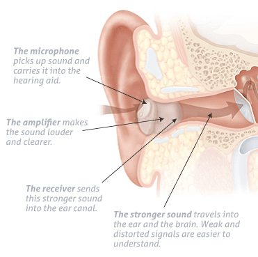 How Hearing Aids Work How Hearing Aids Work
