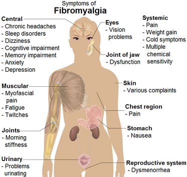 fibromyalgia symptoms