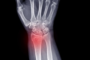 Abstracts in Urgent Care – October 2020 Abstracts in Urgent Care – October 2020