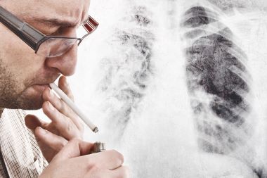 Advise Patients: A Worldwide Respiratory Pandemic is a Bad Time to Start Smoking Again Advise Patients: A Worldwide Respiratory Pandemic is a Bad Time to Start Smoking Again