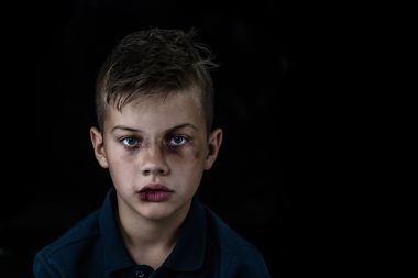 Reported Child Abuse Is Down, but Deaths Are Up. What Can Urgent Care Do? Reported Child Abuse Is Down, but Deaths Are Up. What Can Urgent Care Do?