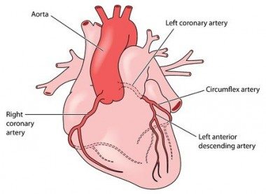 Cardiac Calcium Scoring Chart