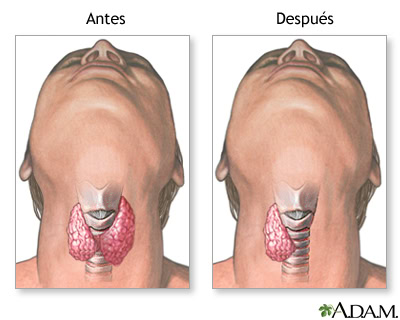 Cirugía endocrina en Córdoba