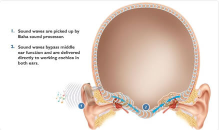 diagram_bone_conduction