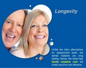 Life of a Dental Implant