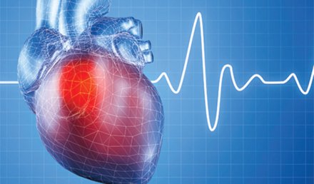 Acute MI After a Normal Stress Test Acute MI After a Normal Stress Test